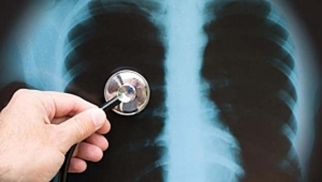 Zatürre bardaktan da bulaşabilir, hapşırıkla da geçebilir