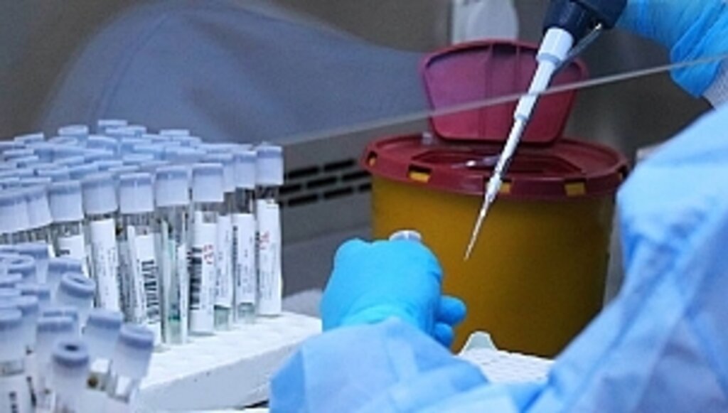 Bakanlık Tarafından Gönderilen Test Cihazlarıyla Samsun'da 